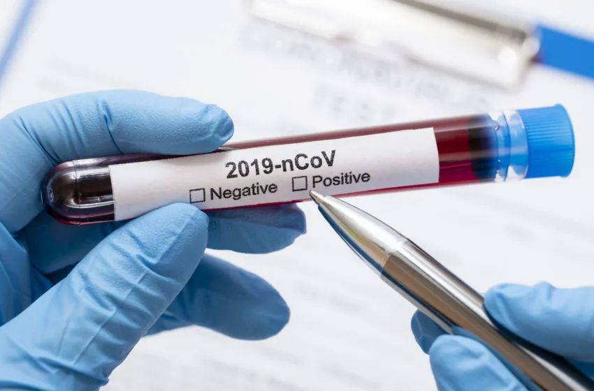  Todos profissionais de saúde deverão ser testados para Covid-19, segundo determinação do TRF